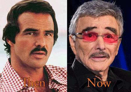 Top Ten Hollywood actors and their Bad Decision of Plastic Surgery ...
