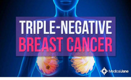 Learn what is Triple Negative Breast Cancer; the big concern of today's women. See its Symptoms and Treatment