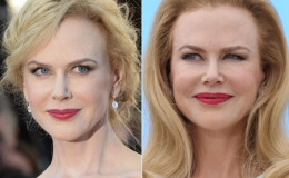 Has Nicole Kidman used Botox Filler; Find about her Plastic Surgery and Relationship