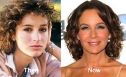 Know about Jennifer Grey Plastic Surgery treatment; See her Before and After photos