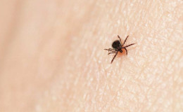 Lyme Disease Is Becoming A Common Problem In The USA Due To Climate Change-Know Its Causes, Signs, And Treatment
 